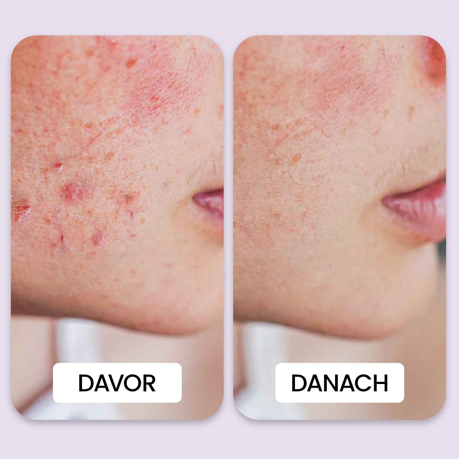 SNOOS™ Overnight Beauty Serum